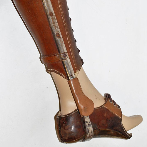Foto einer orthopädischen Beinschiene der 70er